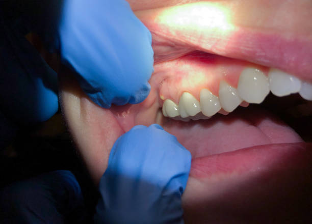 Best Emergency Gum Pain Relief  in University Center, VA