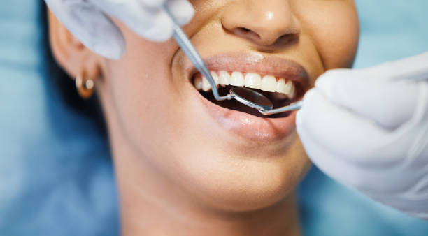 Best Teeth Whitening  in University Center, VA