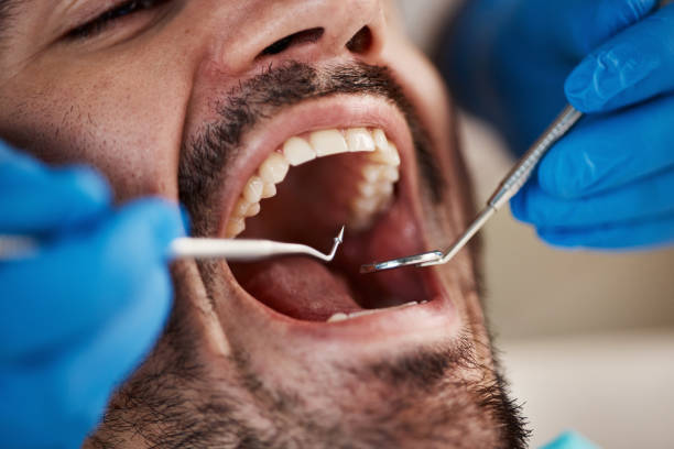 Best Dentist for Severe Toothache  in University Center, VA