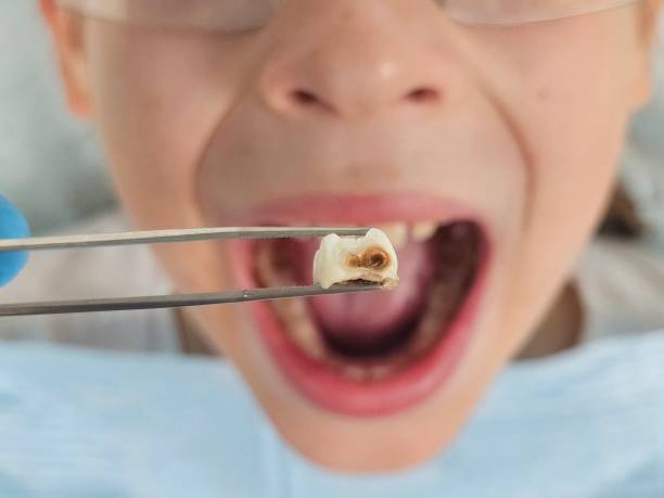 Best Emergency Dentist Near Me  in University Center, VA