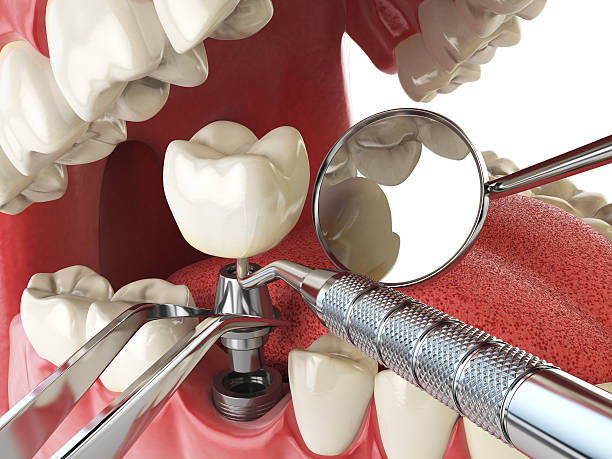 Best Dental Emergency Near Me  in University Center, VA